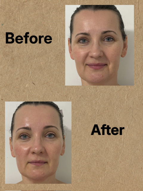 Klara Before and After